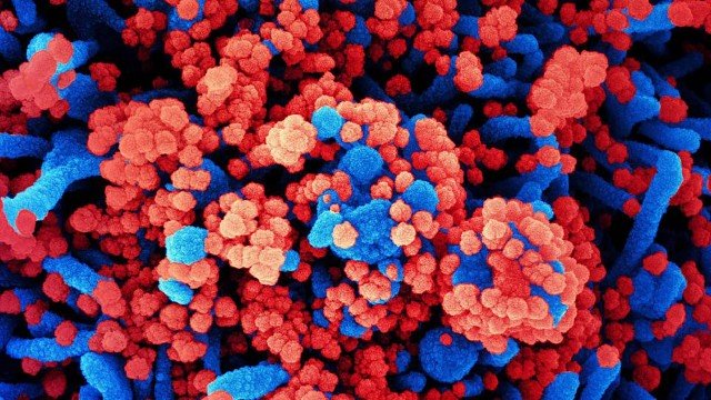 Imagem aumentada de uma célula (azul) infectada com partículas de coronavírus (vermelho)